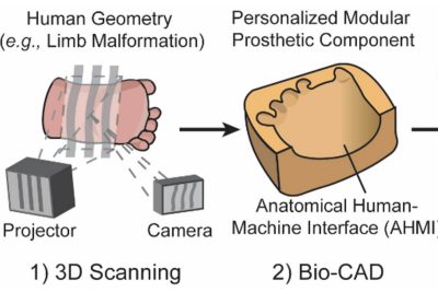 Personalization of Wearable Sensors using 3D Scanning and 3D Printing Technology